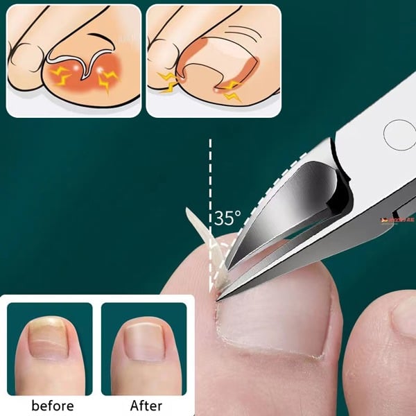 🔥Professional Nail Clipper