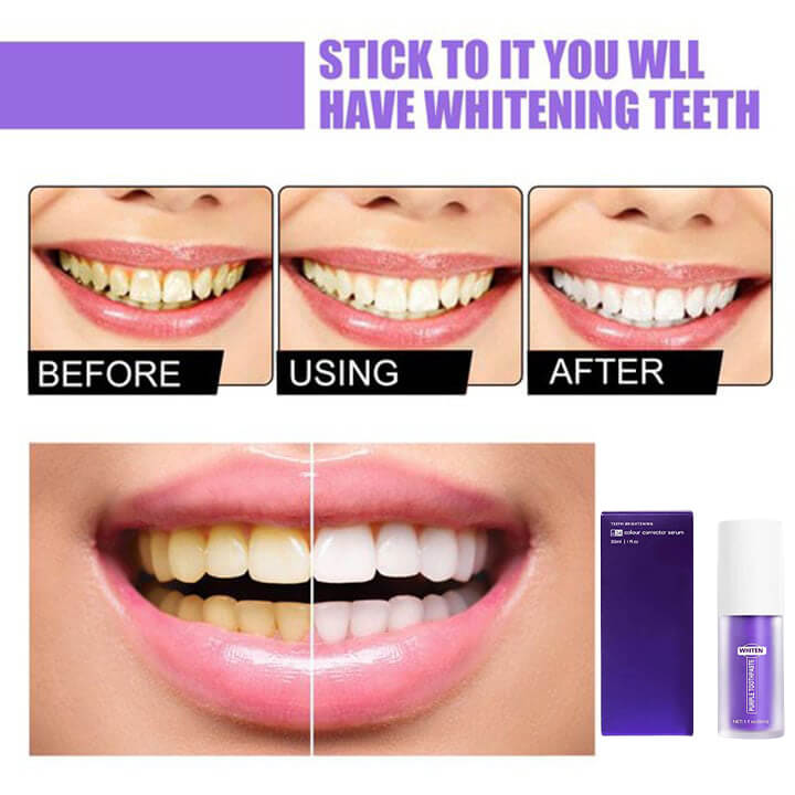 Teeth Colour Corrector Serum