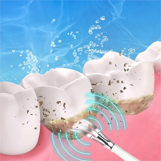 🔥🔥BUY 3 FOR EACH ONLY ￡9.99!!👨‍⚕🦷Electric tooth cleaning instrument -Teeth Cleaner