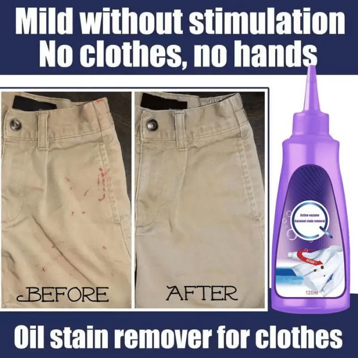 🔥Last Day 49% OFF-Active Enzyme Laundry Stain Remover