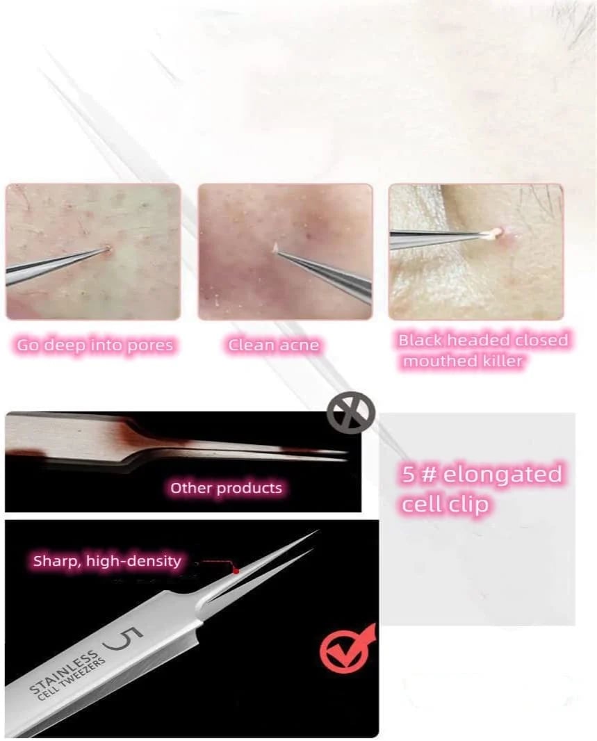 🔥Summer Biggest Sale🔥Professional Facial Blackhead Remover Tweezers