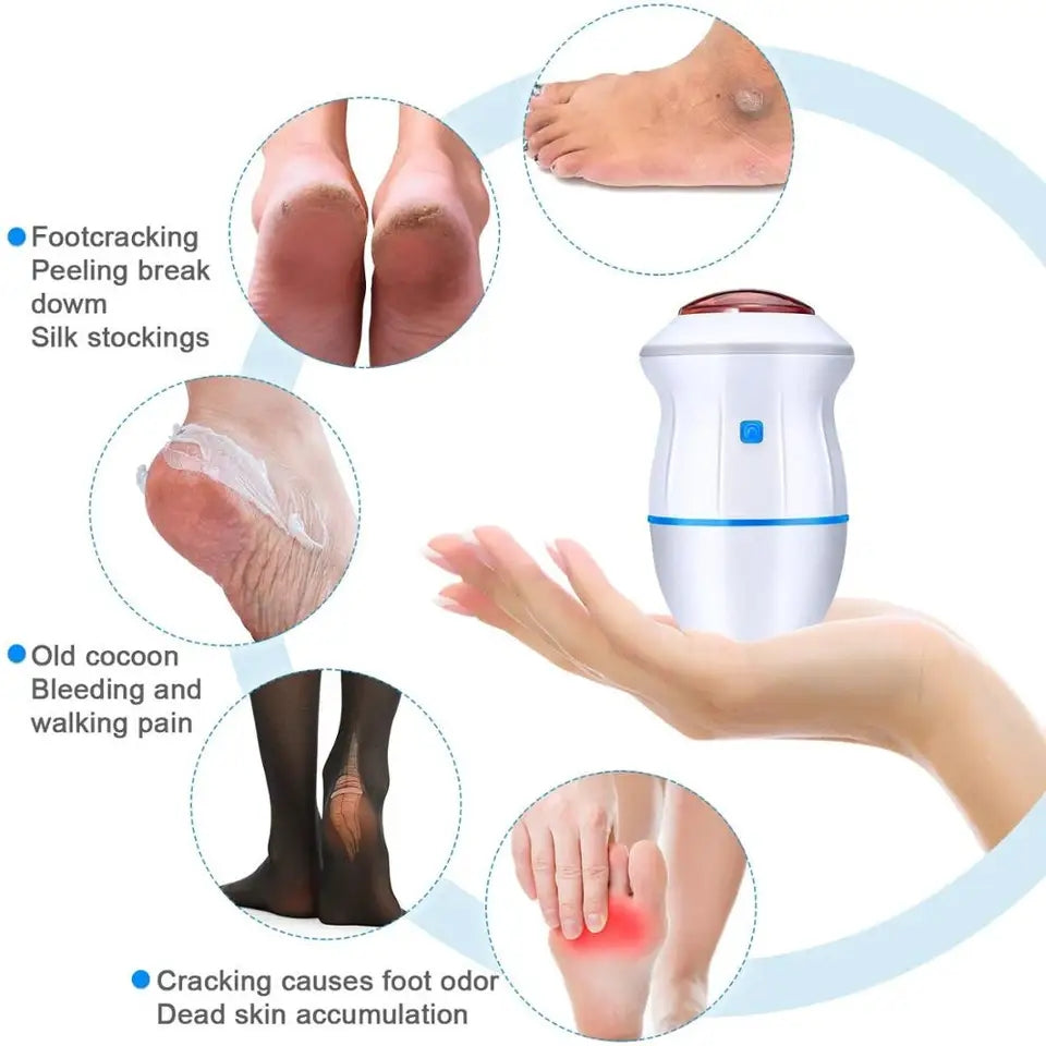 ELECTRIC CALLUS REMOVER FOR FEETS