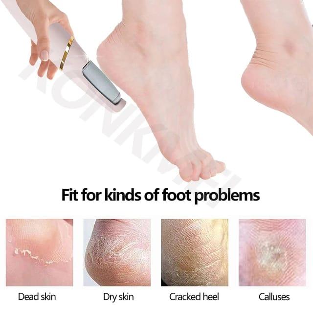 Foot Scrubber (For dry and cracked feet