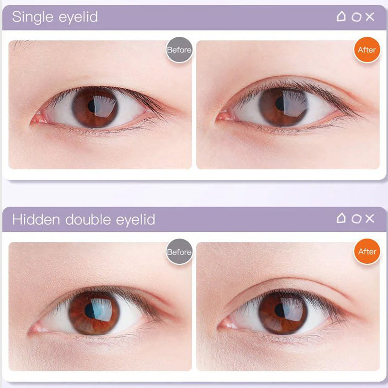 Pousbo® Invisible Self-Adhesive Eyelid Tape