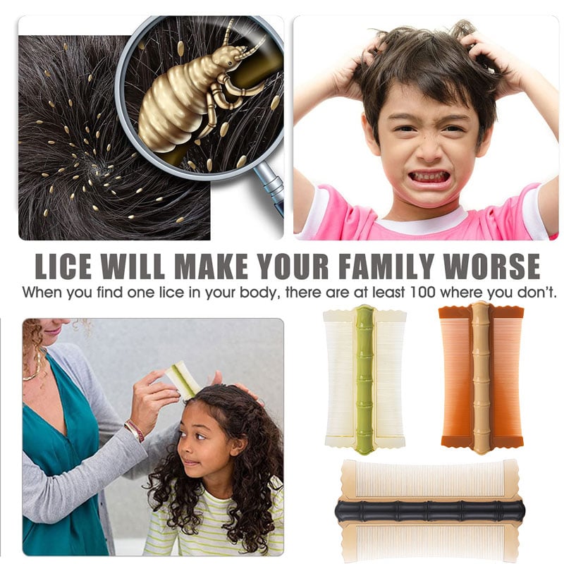 🔥HOT SALE - Lice Comb (Fast Removal of Lice Eggs. Nits and Dandruff)