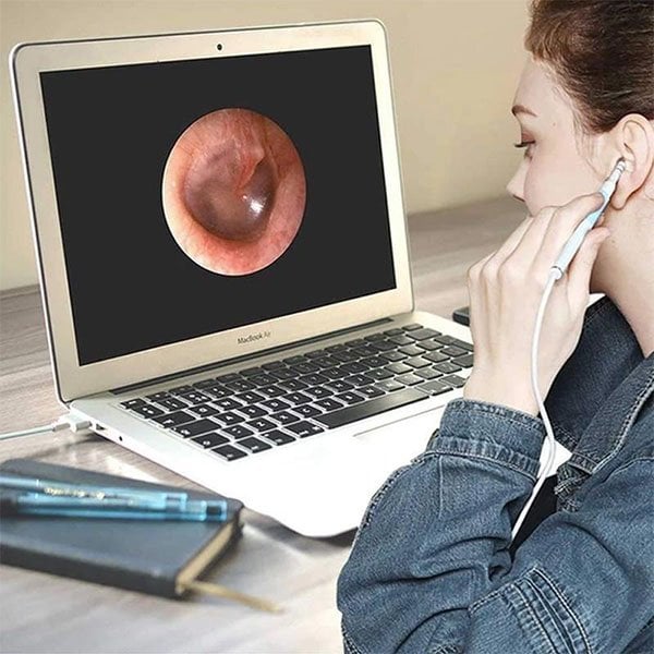 🔥Last day 49% OFF-USB Endoscope🔥-Endoscope ( Universal across all platforms )