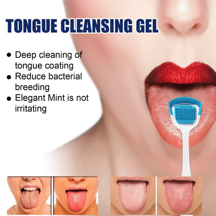 🔥2023New Year Sale -Probiotic Tongue Cleaning Gel Set