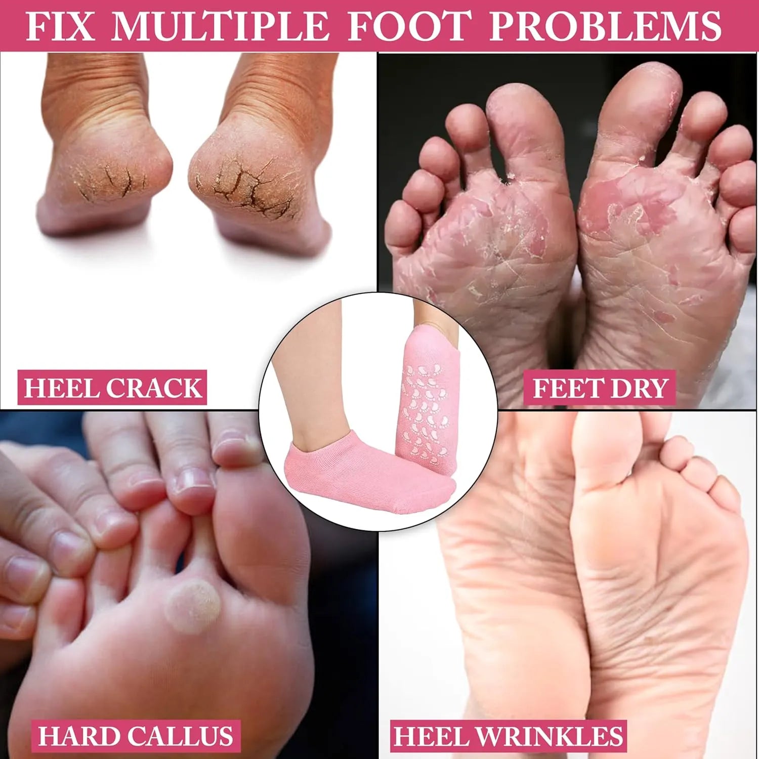 CRACK HEALS SILICONE MOISTURIZING GEL SOCKS