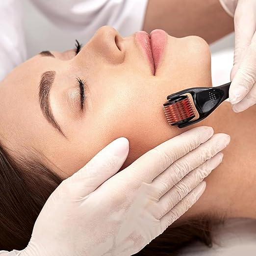 Derma Roller Face Acne Scars Remover