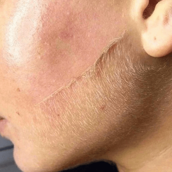 Flawless® Dermaplaning Facial Hair Remover | Exfoliating