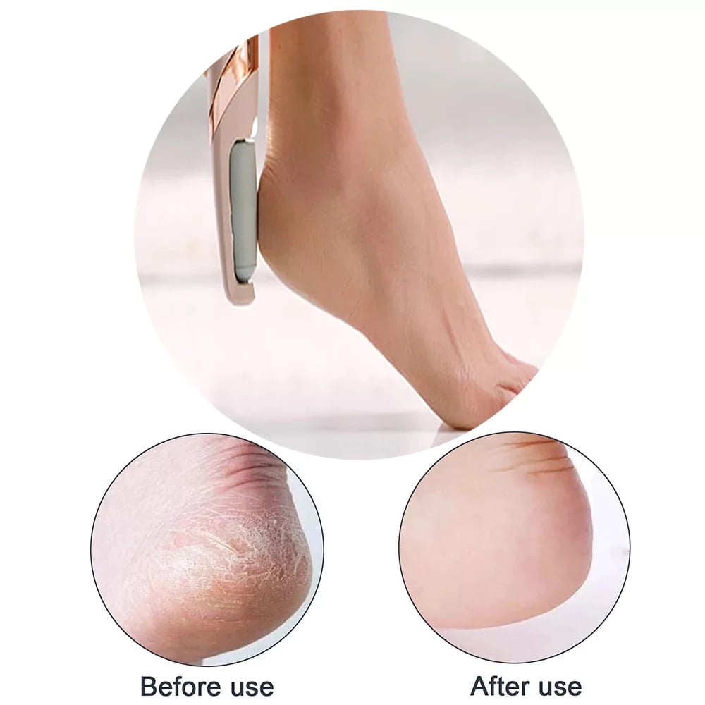 ❣️2023 Latest Electric Foot File Hard Skin Remover