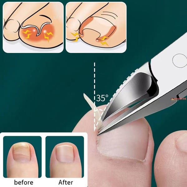 🔥SALE 49% OFF🔥Professional Nail Clipper